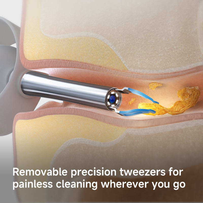 Bebird EarSight Plus Smart Earwax Removal Tool with HD Visual Camera